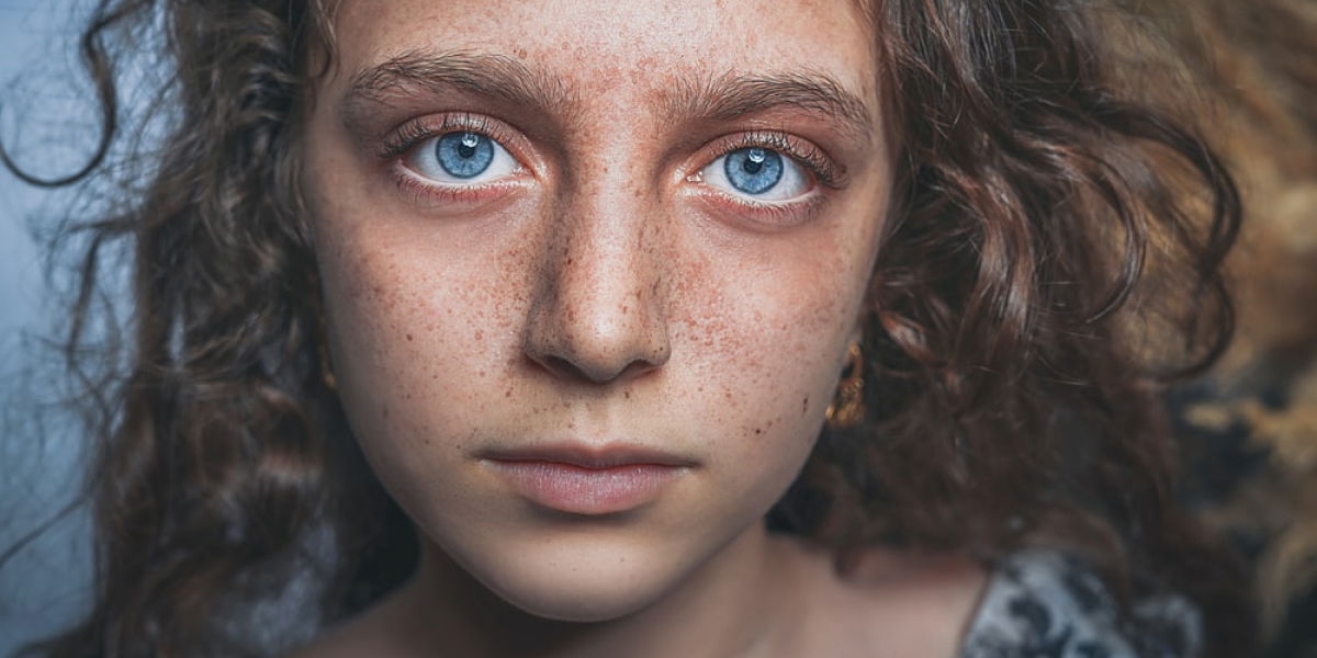 Dark Spot Removal Cream