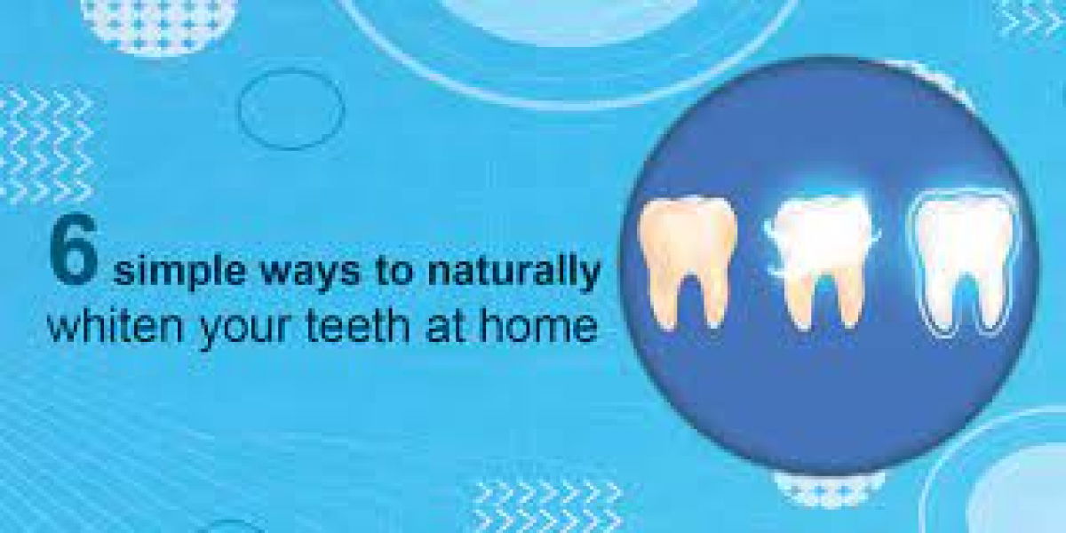 Teeth Whitening at Home