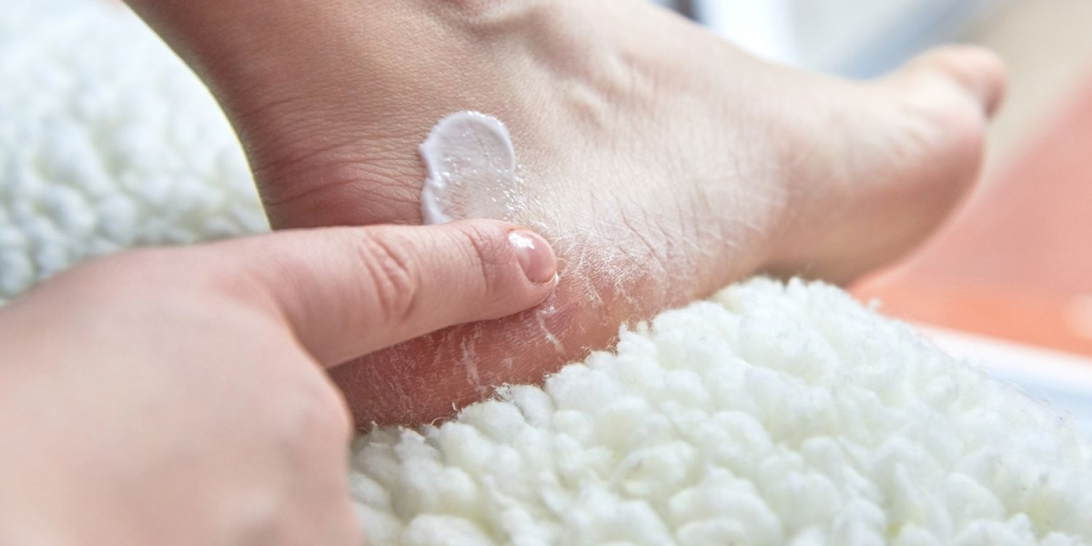 6 Best Antifungal Creams for Infection | Ways to Prevent