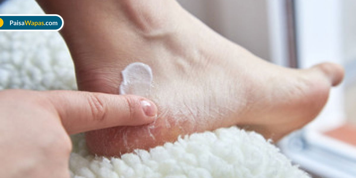 Best Foot Crack Creams for Heel Repair
